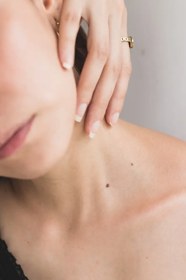 ¿Que es una Dermatitis?